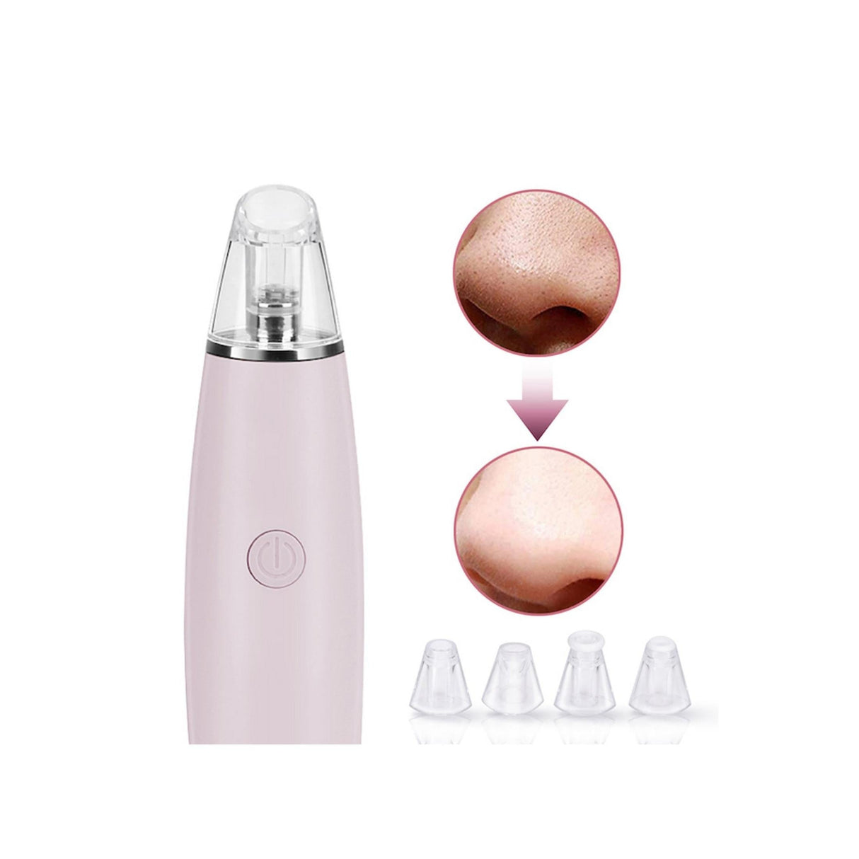 Magnitone PorePatrol Skin Renewing Pore Extraction System - Refurbished Pristine